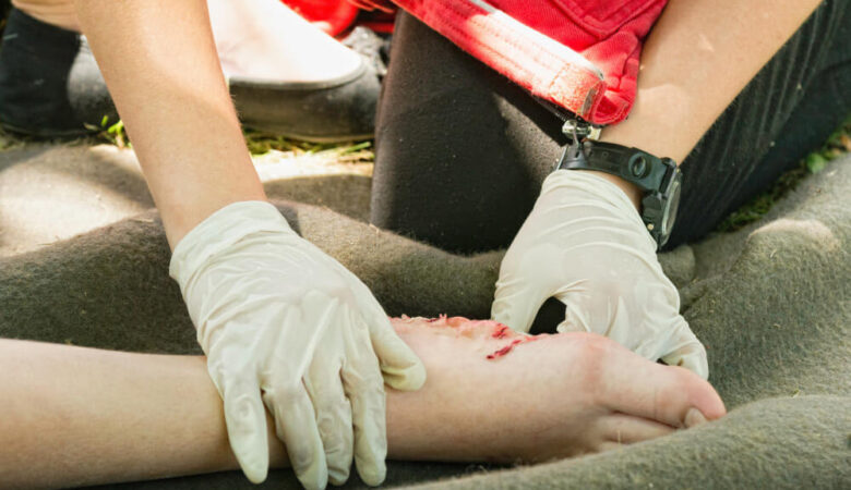 Child Injuries